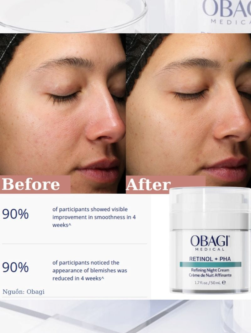 OBAGI Retinol + PHA Refining Night Cream 50ml